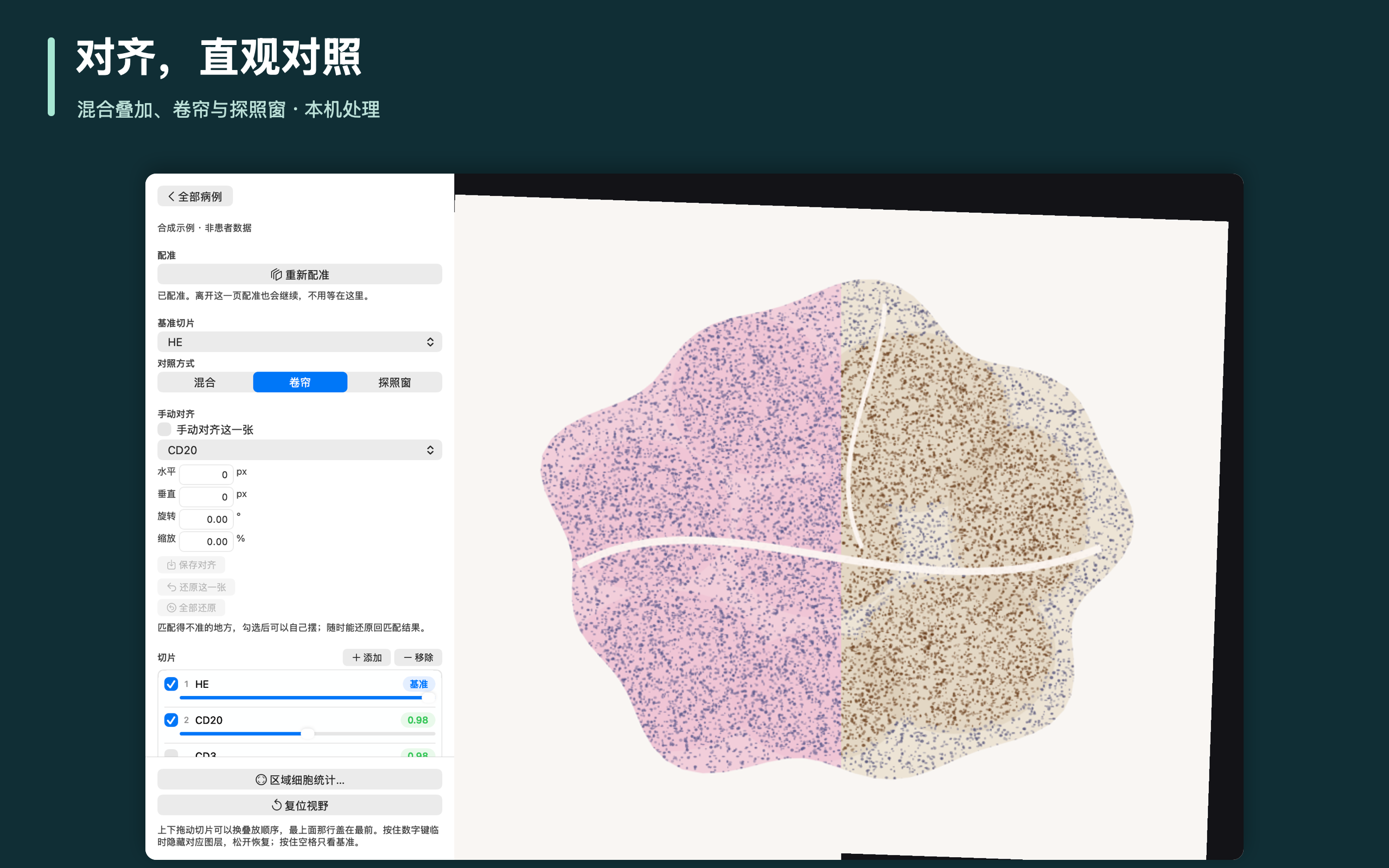对齐，直观对照